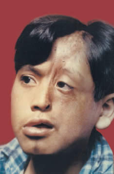 imagen rostro afectado