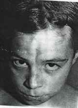 imagen rostro afectado